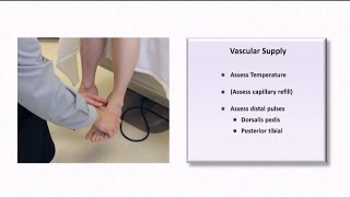 The Diabetic Foot Exam [upl. by Mohandis]